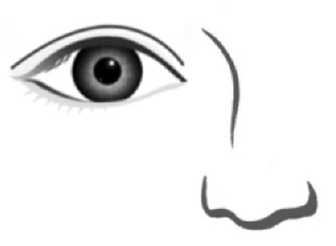 Parallel eyelid crease picture