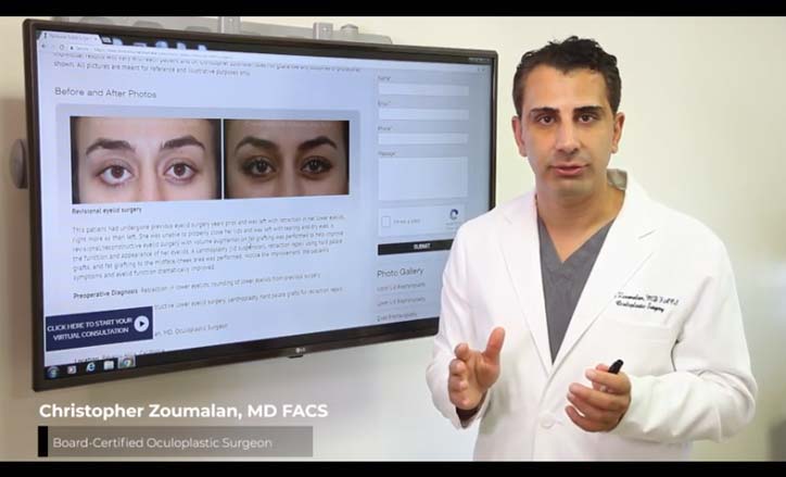 Correcting the Eyelid through Revision Surgery - Click to view the Video