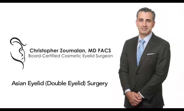 Asian Eyelid Surgery Video