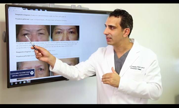 Ptosis Surgery Droopy Eyelids Surgery - Click to view the Video