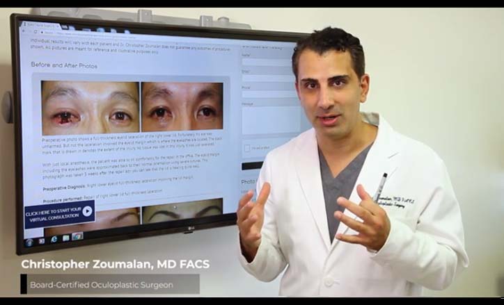Eyelid Trauma - Click to view the Video