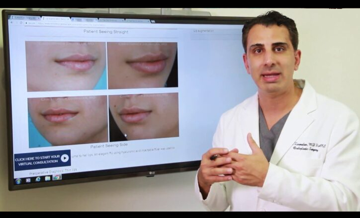 Lip Augmentation Video