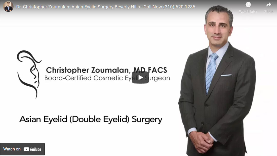 Image of Dr. Christopher Zoumalan: Asian Eyelid Surgery Beverly Hills Click to See Video