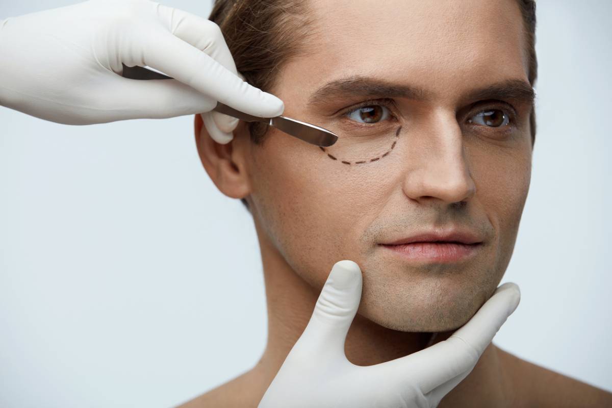 concept image of why men also love eyelid surgery